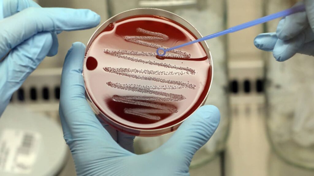 ‘The silent pandemic’: A hotter world makes it harder to stop the spread of deadly superbugs ‘The silent pandemic’: A hotter world makes it harder to stop the spread of deadly superbugs