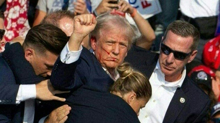 Trump’s former doctor gives health update after shooting, calls out Wray for doubt about bullet Trump’s former doctor gives health update after shooting, calls out Wray for doubt about bullet