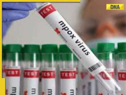 First case of Mpox confirmed in India, patient put under isolation First case of Mpox confirmed in India, patient put under isolation