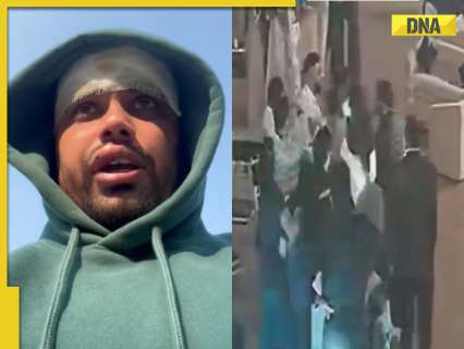 UPSC coach claims IPS trainee broke glass on his head at Delhi wedding, FIR lodged