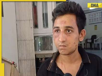 Vadodara Car Accident: Drugs found in accused Rakshit Chaurasia’s blood in narcotics test Vadodara Car Accident: Drugs found in accused Rakshit Chaurasia’s blood in narcotics test