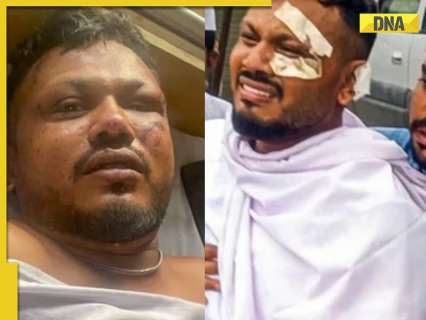 Ahmedabad Horror: Air India’s lone crash survivor shares grief, says, ‘God gave me my life but…’ Ahmedabad Horror: Air India’s lone crash survivor shares grief, says, ‘God gave me my life but…’