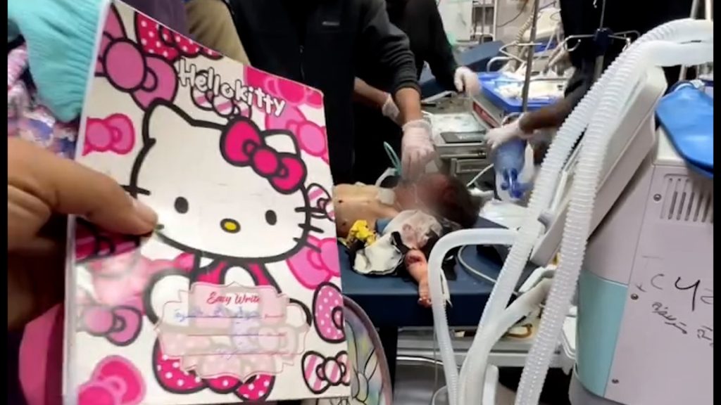 Doctors try to save girl as father was killed in Gaza Israeli attack