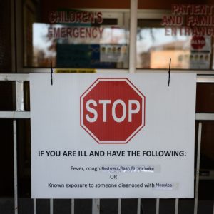 If Texas measles outbreak is still spreading, U.S. could lose measles-free status, scientists say