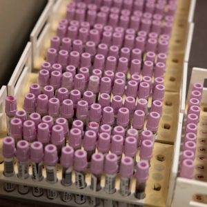 State health officials declare West Texas measles outbreak over