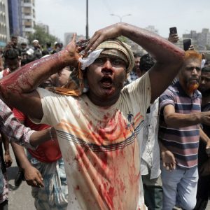 Shot in the eyes, victims of Bangladesh protest violence face dark future