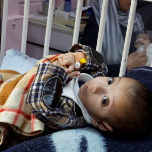 UNRWA sounds alarm as 1 in 10 children in Gaza malnourished