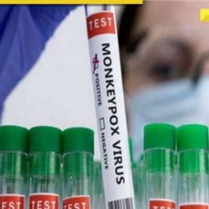 Mpox scare: India on high alert as Monkeypox cases rise globally, Centre asks authorities to…