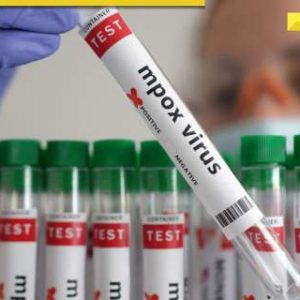 MPox Clade 1 variant reported in this Indian state, know symptoms