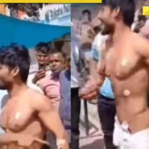Man, said to be in coma, walks out of ICU casually, alleges he was being held captive by hospital for…