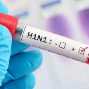Delhi Reports 1,344 H1N1 Cases: Are you at risk? Know symptoms and prevention