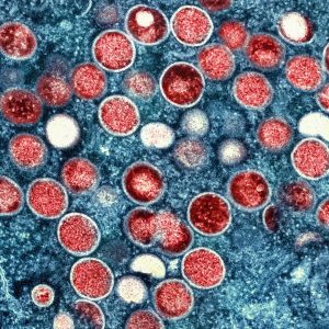 Sierra Leone declares emergency over mpox outbreak