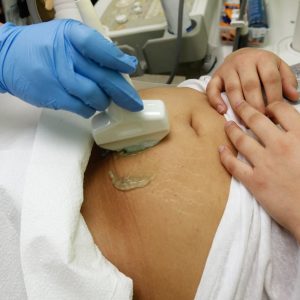 Maternal deaths surged in Texas in 2020, 2021