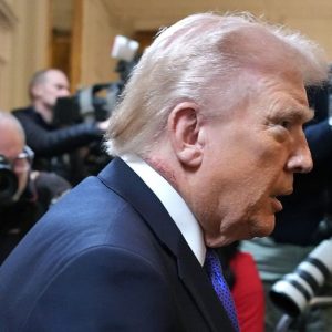 White House doctor explains Trump’s visible neck rash