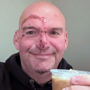 Sen. Fetterman shares graphic photo after heart rhythm scare, says doctors ‘put me back together’